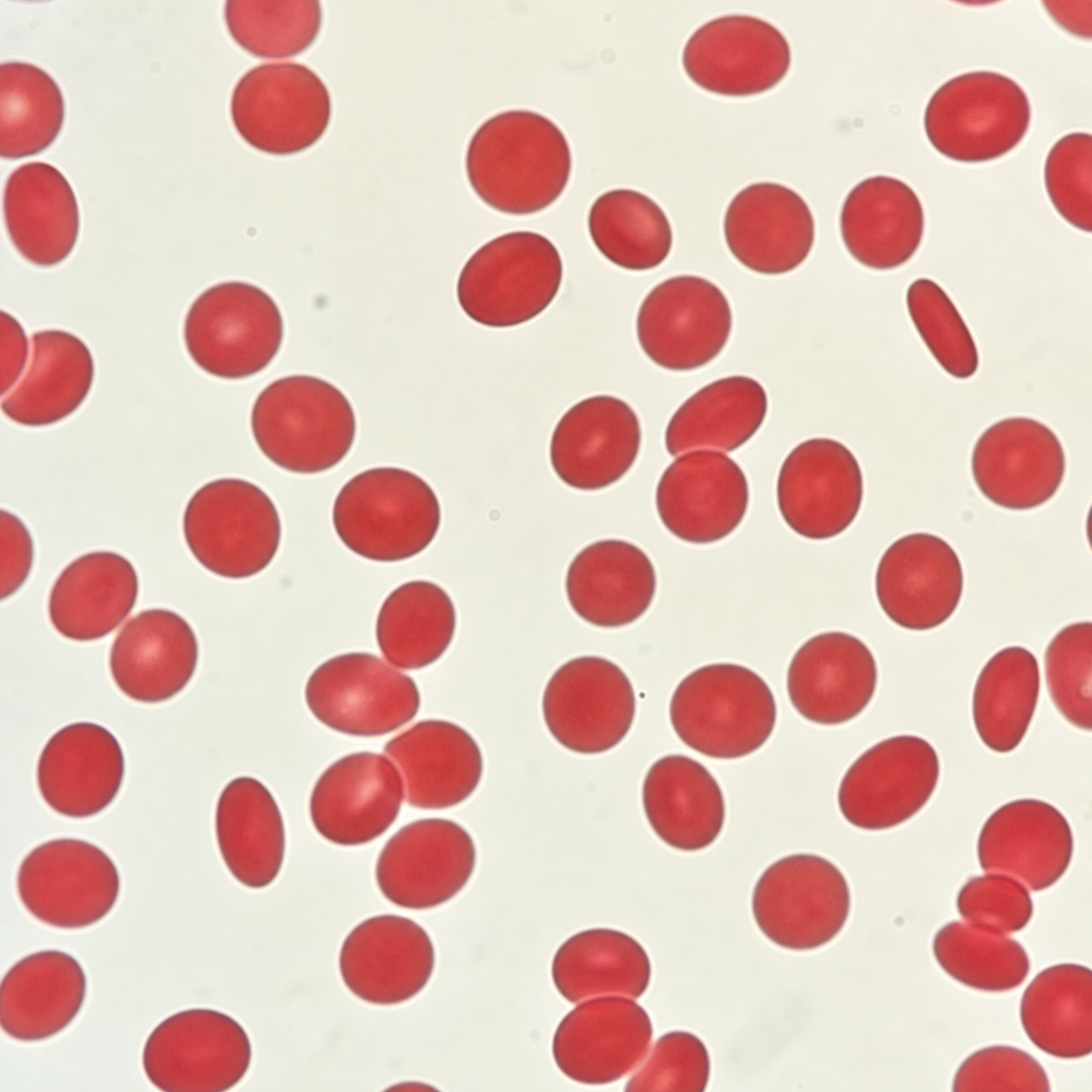 Live blood microscopy style image showing red blood cells