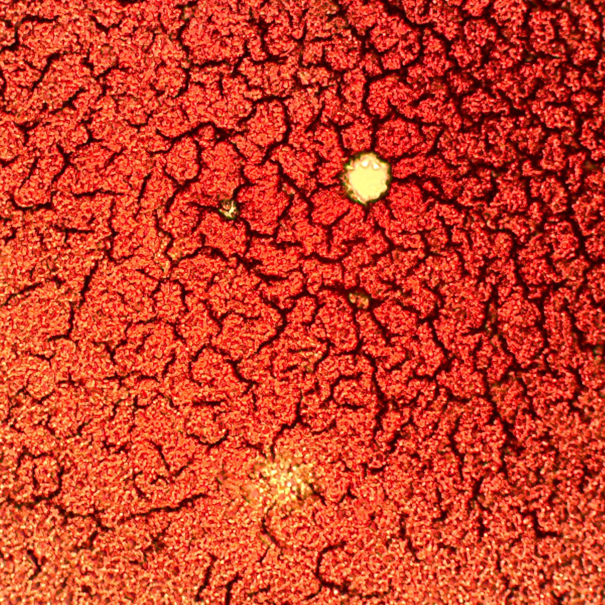 Dry blood analysis style image showing dried blood sample patterns